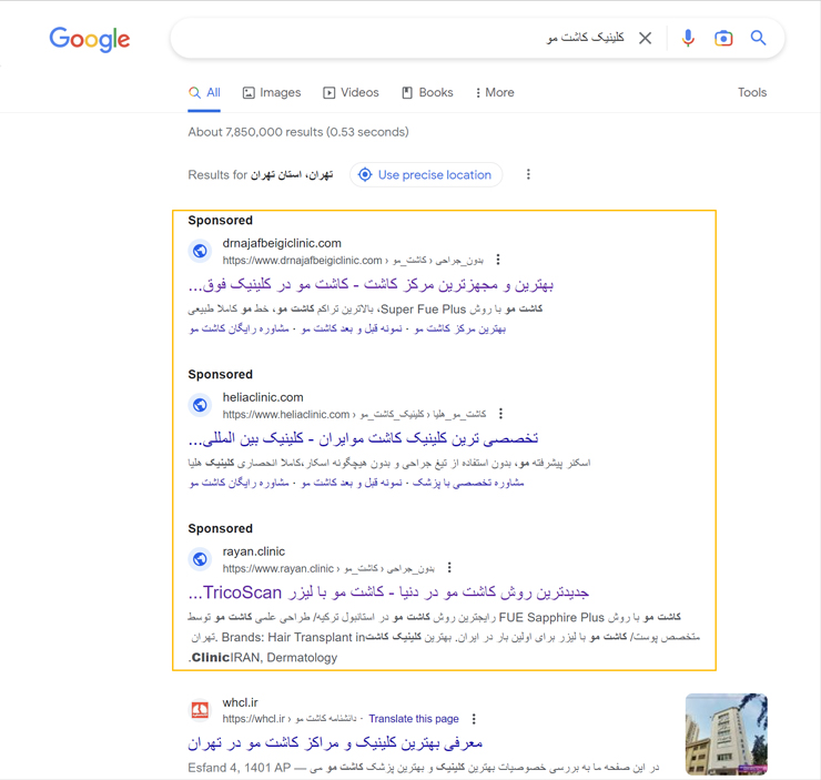 نمونه تبلیغات کاشت مو در گوگل